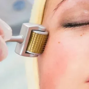 Affordable Microneedling Services in Novi