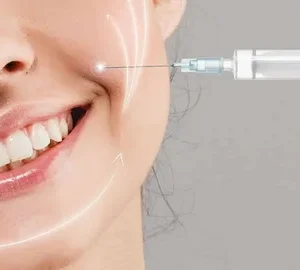 Filler in Novi