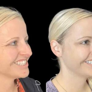 Explore the Best Aesthetic Clinics in Dubai for Botox and Wrinkle Reduction