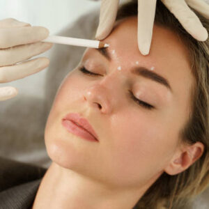 Botox injections in Dubai