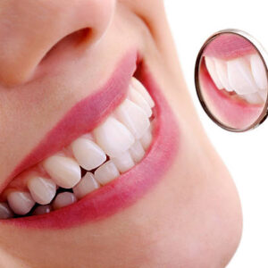 Teeth Whitening in Riyadh