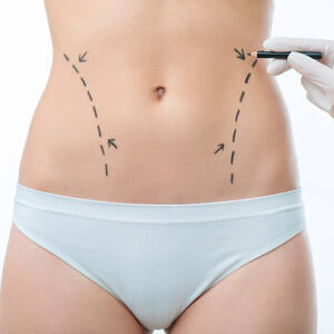 Body Sculpting in Riyadh