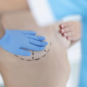 Breast Reduction in Riyadh | Safe & Trusted Procedures 2025