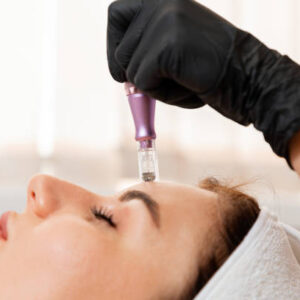 Derma Pen
