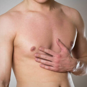 Gynecomastia Surgery in Riyadh