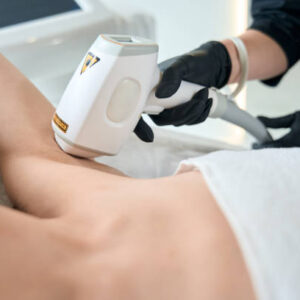 Laser Hair Removal in Riyadh