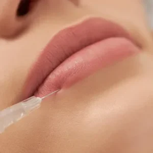 p fillers in Novi