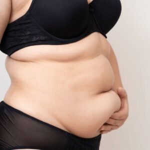 Liposuction in Riyadh