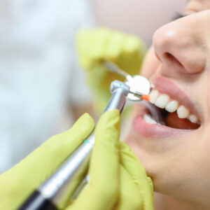 Teeth Cleaning and Polishing in Riyadh