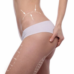 Thigh Lift in Riyadh