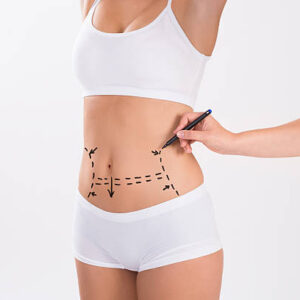 Tummy Tuck in Riyadh