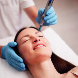 Where to Book Dermapen KSA | Rejuvenate Your Skin Today