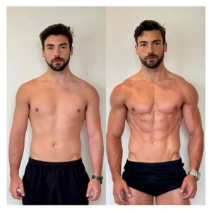 Gynecomastia Surgery in Riyadh