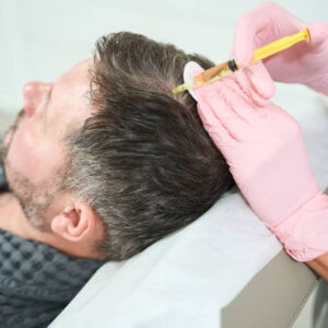 PRP Aftercare Tips – Maximize Results in Riyadh