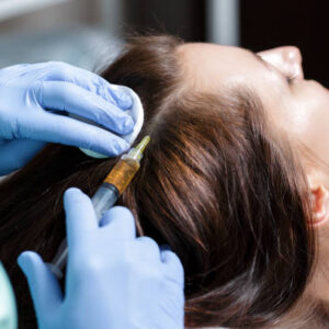 Riyadh’s Latest PRP Hair Trends