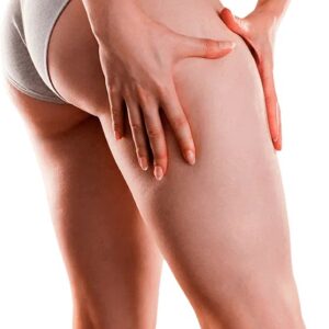 Thigh Lift Surgery in Riyadh