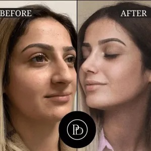 Glowing Skin Starts Here: PRP Treatments in Dubai