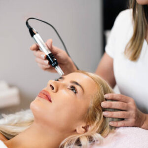 Derma Pen Treatments for Stretch Mark Improvement