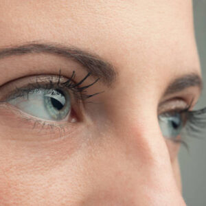 Eyelid Surgery in Riyadh