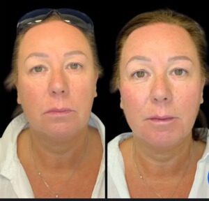 Best Plastic Surgeon in Dubai: Trusted Care and Expertise