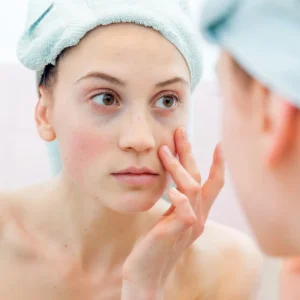 Dark Circles Treatment in Riyadh