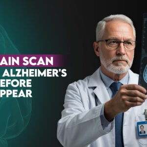 MRI Brain Scan May Predict Alzheimer's Risk