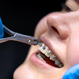 Orthodontics in Indirapuram